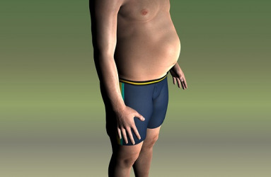 obesity-induced_steatosis.jpg